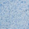 Жидкие обои Silk Plaster Жидкие обои Жидкие обои Victoria 717, Голубой
